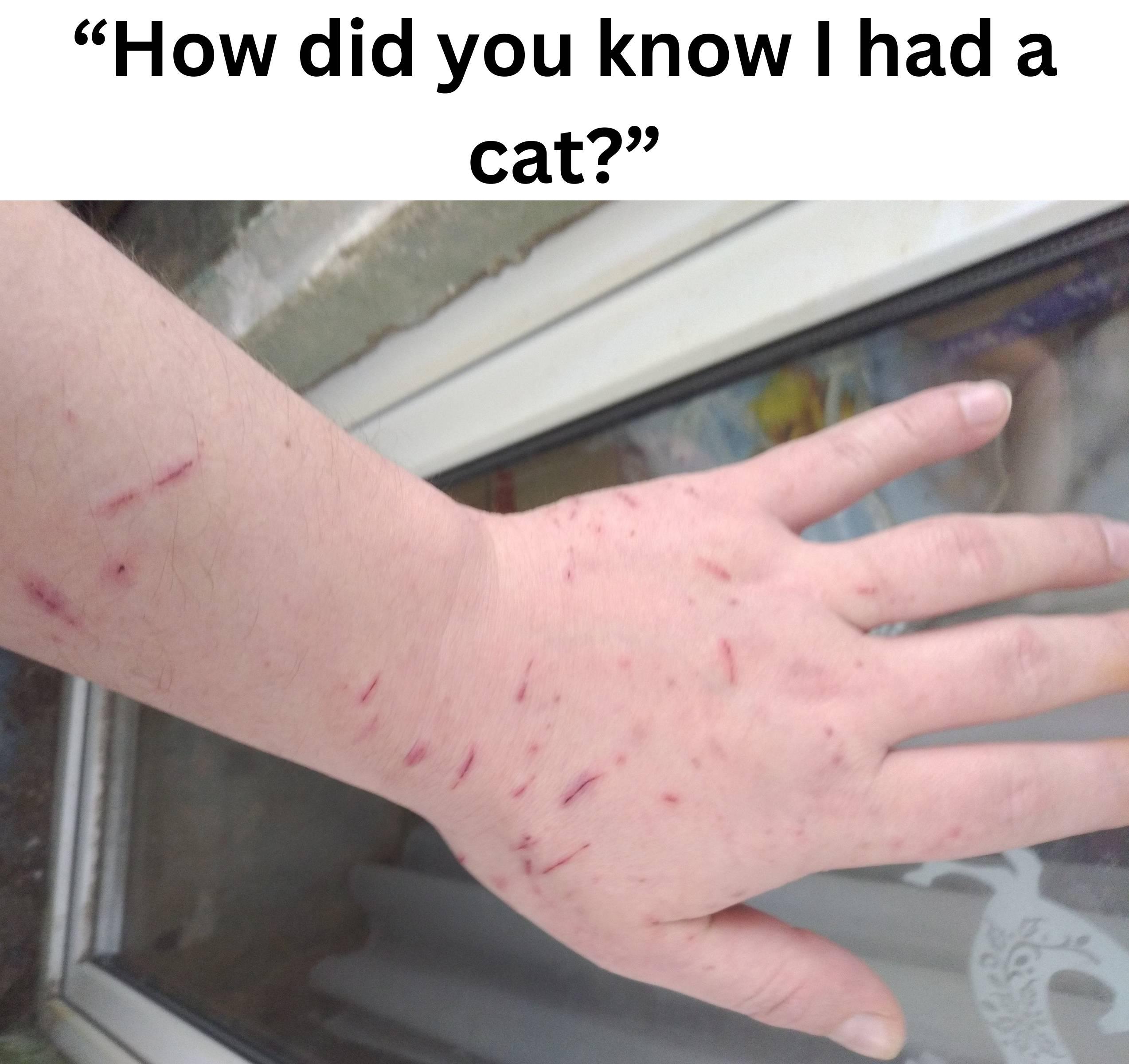 A hand with multiple cat scratches and the text "How did you know I had a cat?"